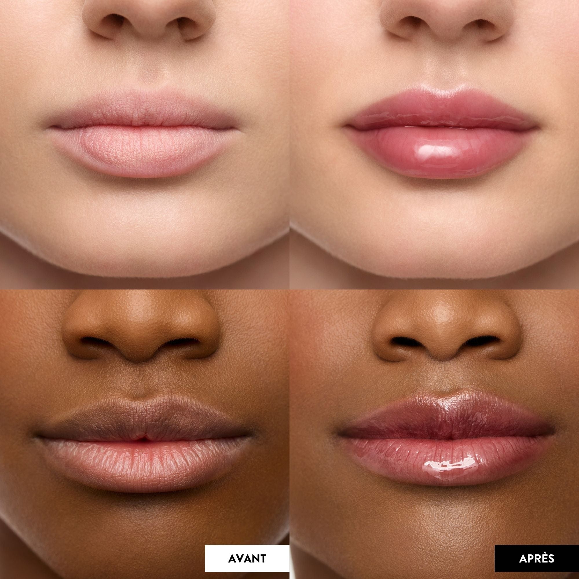 Lip Oil Rehab - Huile à lèvres