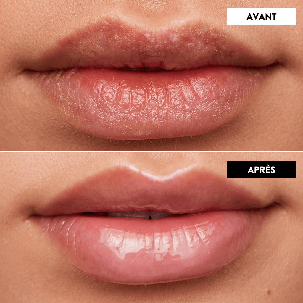 Lip Oil Rehab - Huile à lèvres